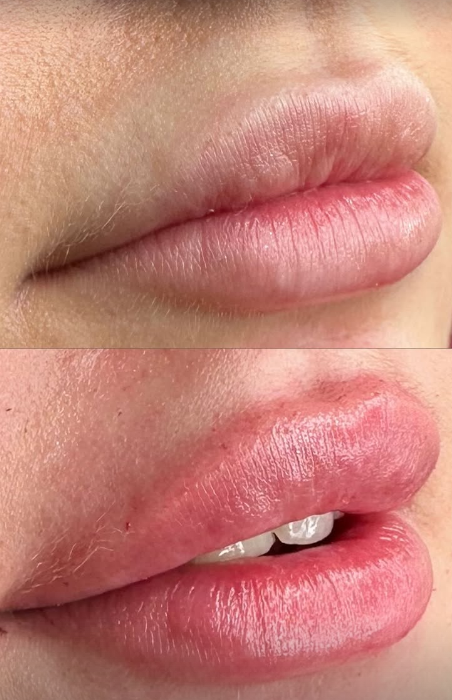 Before and After Result 1